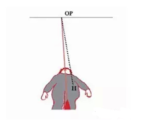 悬吊训练治疗技术--基本概念和应用(图14)