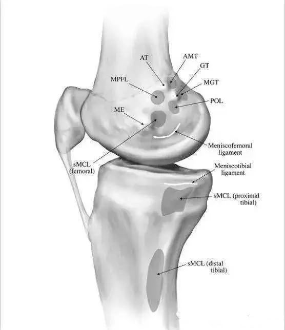 健朗医疗：为什么膝关节内侧疼痛比外侧更多见(图2)