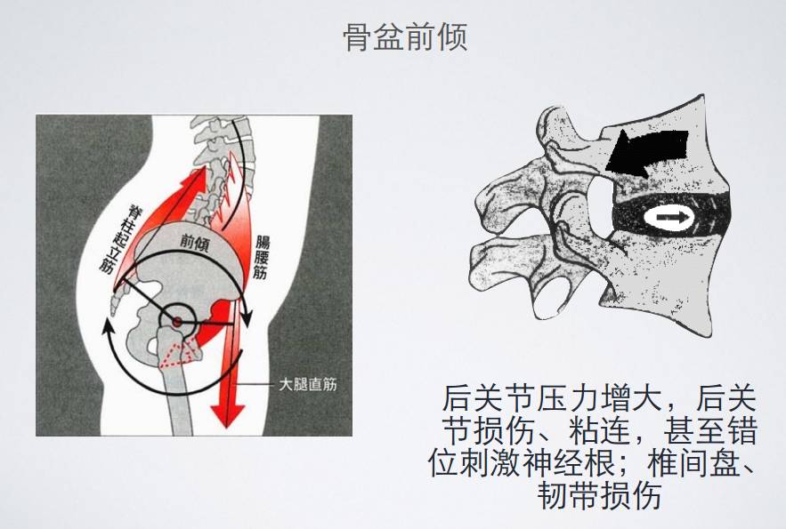 改善慢性腰痛，悬吊只需要三招(图2)