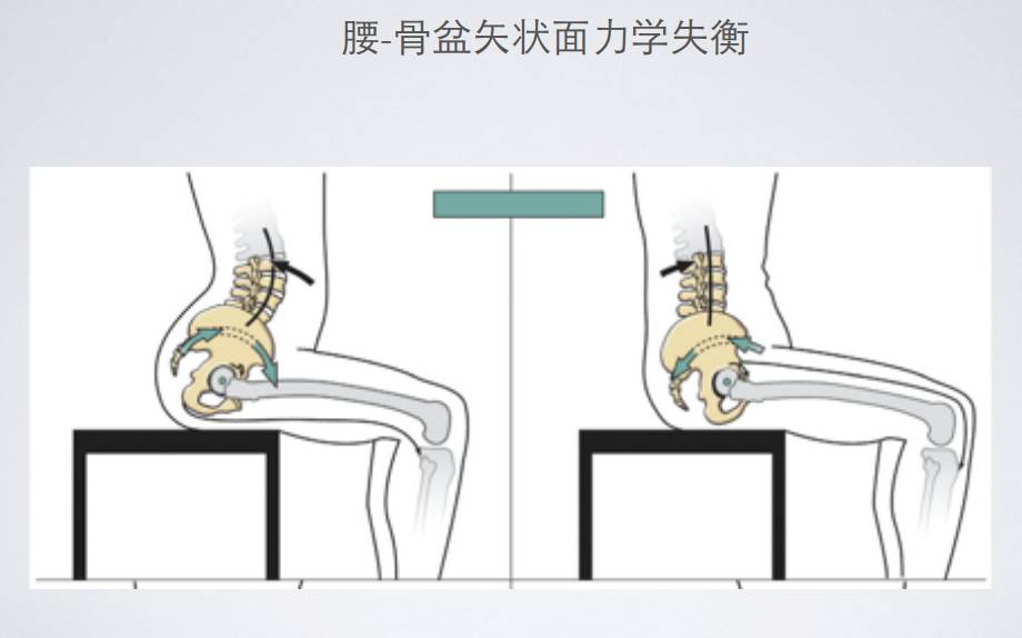 改善慢性腰痛，悬吊只需要三招(图1)